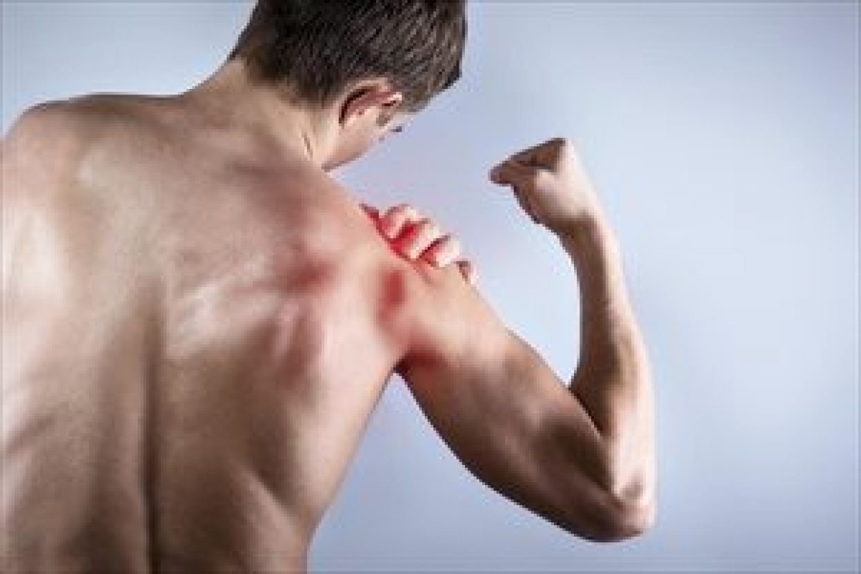 In questo articolo, Simona Massetti ci parla di borsite alla spalla, una delle più comuni cause del dolore alla spalla, e sul recupero da essa!
